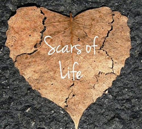 Scars Of Life